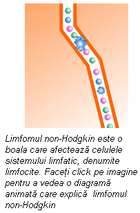 Stadiile de dezvoltare ale limfomului non-Hodgkin